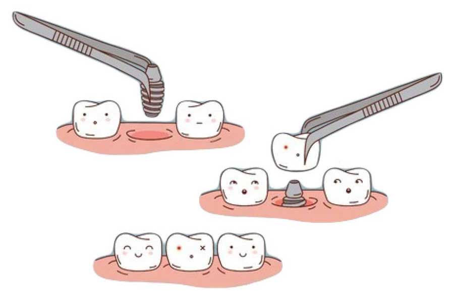 Cirugía e implantes