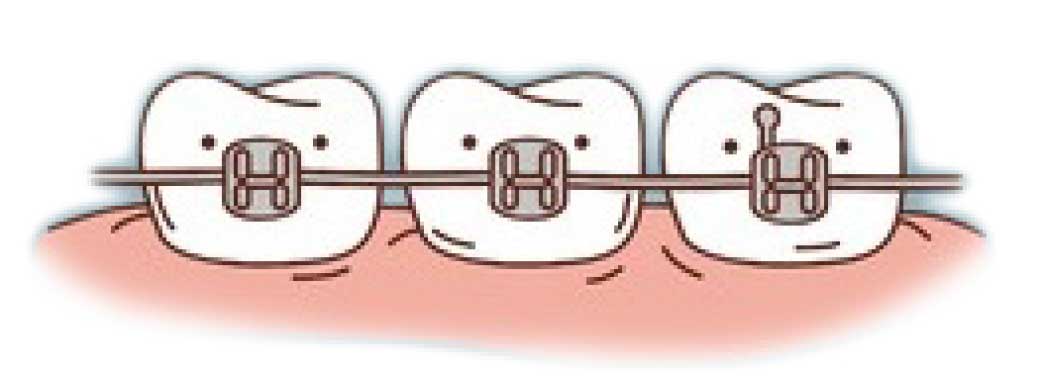 Ortodoncia y ortopedia